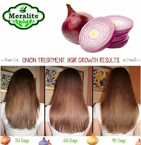 Onion Oil For Hair Growth And Skin Care 35 Ml With 15 Essential Oils And Other Powerful Ingredients-thumb2