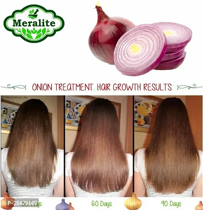 Onion Oil For Hair Growth And Skin Care 35 Ml With 15 Essential Oils And Other Powerful Ingredients-thumb3