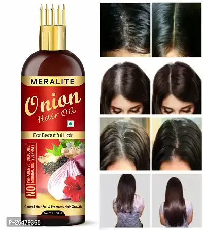 Onion Hair Oil With Comb Applicator Controls Hair Fall No Mineral Oil Silicones Cooking Oil And Synthetic Fragrance