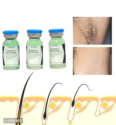 Permanent Hair Removal cream/ Facial hair removal/ private part hair removal/ stop hair growth-thumb4