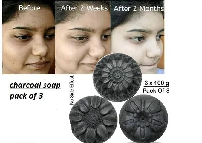 Top Selling Activated Charcoal Soap