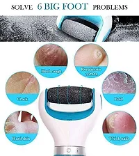 thriftkart Foot Roller Callus Remover Hard And Dead Skin Remover Care (Multi Color)-thumb1