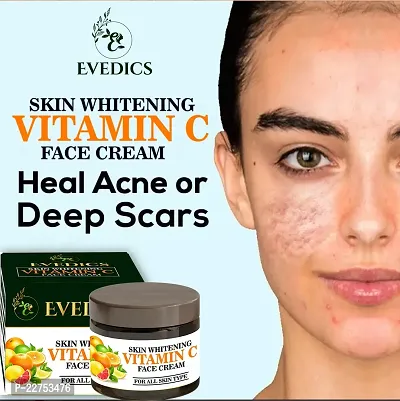 Evedics Skin Whitening Face Cream Look as young as U feel -Acne Care Face Cream, Face Cream For Oily Skin, Dry Skin   Normal Skin, Anti Pimple Cream,  Face Cream For Men and women 50 gm