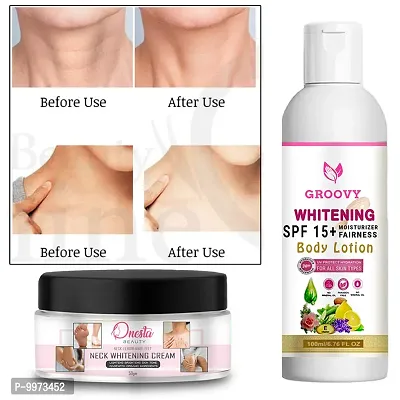 &nbsp;Skin Brightening Cream for FACE | BODY Whitening Cream|Dark Spot Remover  100gm) with whitening cream-thumb0