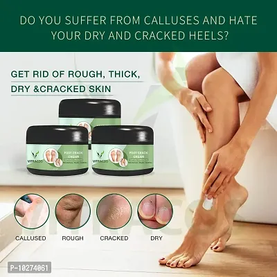 Organic Foot Care Cream Nourishing, Moisturizing And Non Greasy 50Gm + 50Gm + 50Gm Pack Of 3