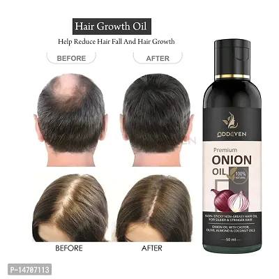 Red Onion Hair Oil Controls Hair Fall - No Mineral Oil ONION HAIR OIL (50ML) (PACK OF 1)-thumb0