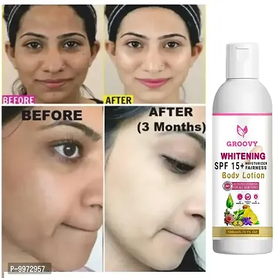 Skin Whitening Lotion Cream Look as young as U feel  Acne Care Face Cream with whitening cream-thumb3