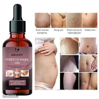 Stretch Marks Oil  Body stretch mark removal Oil | Anti Aging | Pregnancy Stretch Mark Removal Oil| Scar Removal | Anti Wrinkle | Skin Hydration -40ml-thumb0