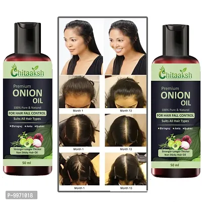 Red Onion Hair Oil   With Deep Root Hair Applicator   Controls HairFall   Promotes Growth   Hair Oil 50ml  PACK OF 2-thumb0