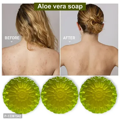 Aloe Vera Bathing Soap For Healthy Skin-100 Grams Each, Pack Of 3-thumb0