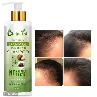 Ayurveda Amla Reetha Shikakai Shampoo For Hair Growth Ayurvedic Anti Hair Fall And Anti Dandruff Shampoo 200Ml-thumb0