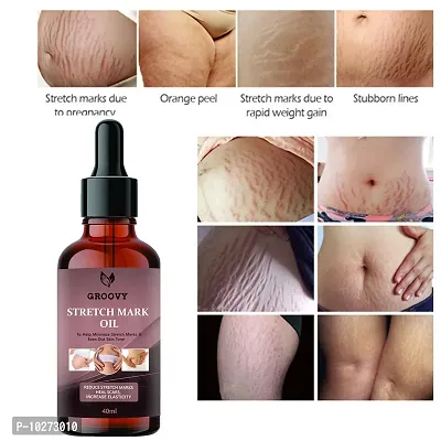 Stretch Marks Oil Body Care Oil - Scars, Pregnancy Stretch Mark,Ageing,Uneven Skin Tone 40Ml-thumb0