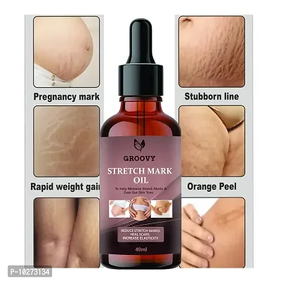 Stretch Marks Oilpregnancy And Maternity Stretch Marks Removal Cream Stretch Marks Oils 40Ml-thumb0