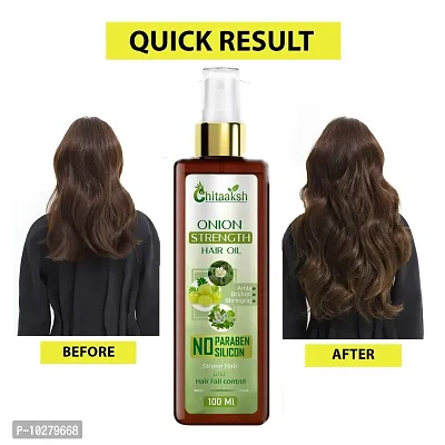 Onion Herbal Hair Oil For Hair Growth And Hair Fall Control With 12 Essential Oils Men And Women Natural Herbal Hair Oil For Clean And Healthy Scalp Chemical Free Paraben Free-thumb0