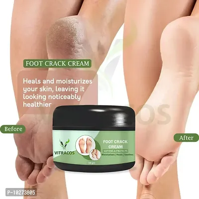 Foot Cream Looking Nutri Height Capsules Darar For Cracked Heels Antiseptic Cream For Man.