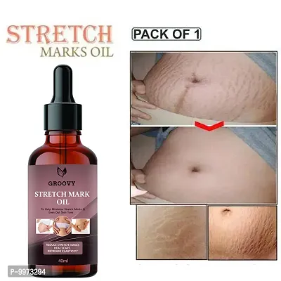 Stretch Marks Oil  Stretch Mark Oil for Women  Men - Scars  Uneven Skin Tone  Spots Removal oil  40 ml) PACK OF 1-thumb0