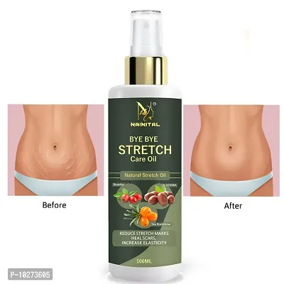 Nainital Advance Repair Stretch Marks Removal - Natural Heal Pregnancy Breast, Hip, Legs, Mark Oil 100 Ml-thumb0