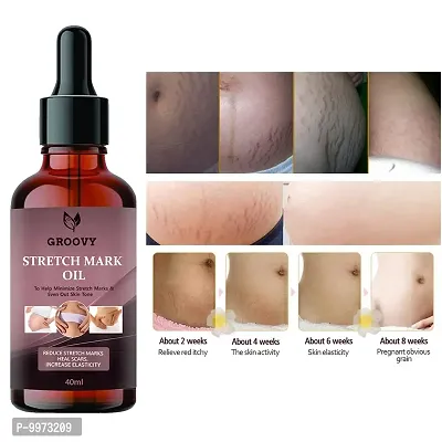 Stretch Marks Oil  organics Natural Stretch Oil with Coconut  Yasti  Tilatel Oils  For Scars  Stretchmarks  40 ml)-thumb0