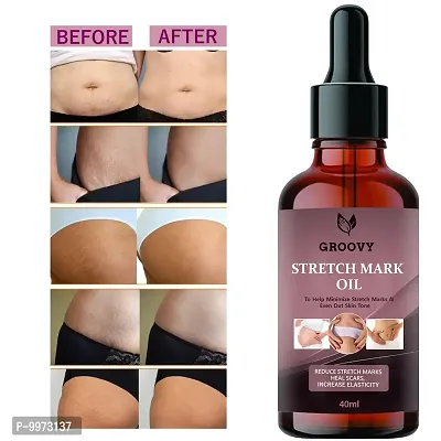 Stretch Mark Cream to Reduce Stretch Marks  Scars-40ml  40 ml) PACK OF 1-thumb0