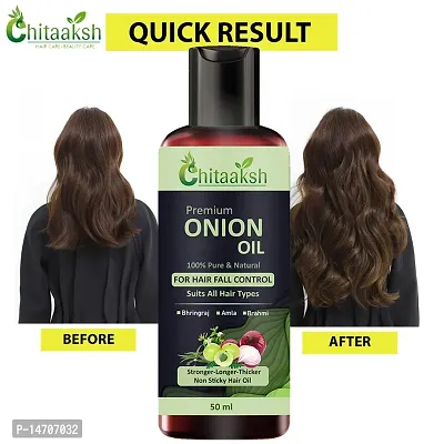 ONION OIL ANTI HAIR LOSS  HAIR GROWTH OIL WITH PURE ARGAN, BLACK SEED OIL IN PUREST FORM VERY EFFECTIVELY CONTROL HAIR LOSS, PROMOTES HAIR GROWTH 50ml-thumb0