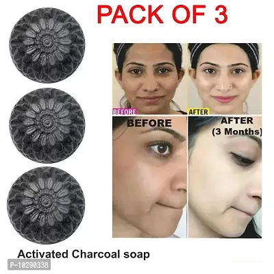 Charcoal Cleansing Soap- Pack Of 3, 100 Grams Each