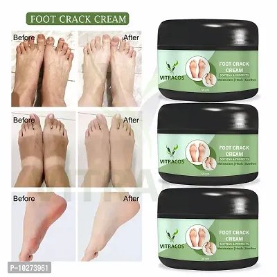 Foot Care Cream For Rough, Dry And Cracked Heel Feet Cream For Heel Repair Healing And Softening Cream 50Gm + 50Gm + 50Gm Pack Of 3-thumb0