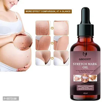 Stretch Marks Oil Organics Stretch Mark Oil - Scars  Stretch Mark  Ageing  Uneven Skin Tone  40 ml)-thumb0