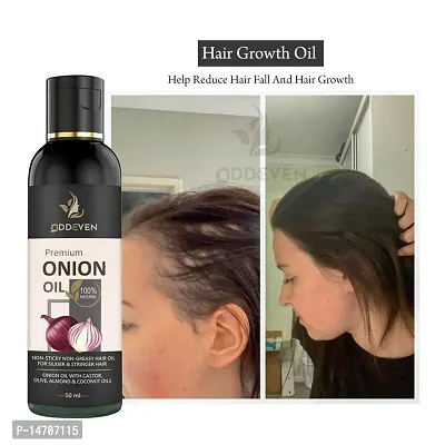 Red Onion Hair Oil with Keratin Protein booster, Nourishes hair follicles, Anti - Hair loss, Regrowth ONION HAIR OIL (50ML) (PACK OF 1)-thumb0