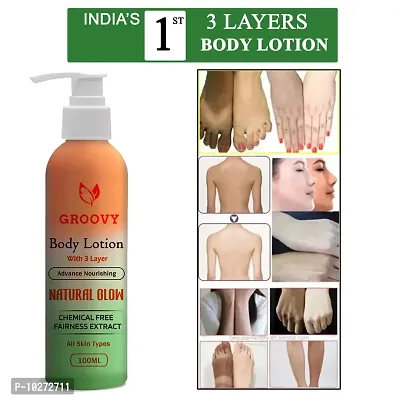 Skin Whitening Face Lotion For Oily Skin, Anti Pimple Lotion,- 100 Ml