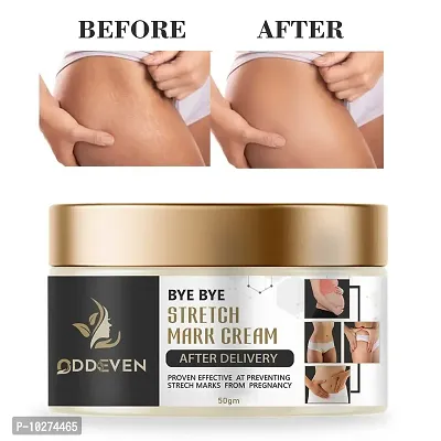 Oddeven Stretch Cream For Stretch Marks Removal Post Pregnancy Fast Work 100% Result Stretch Mark Cream Oil 50 G,