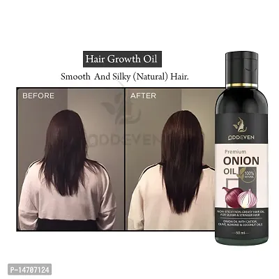 Onion Hair Oil for Hair Growth with Onion  Black Seed for Hair Fall Controlnbsp; ONION HAIR OIL (50ML) (PACK OF 1)