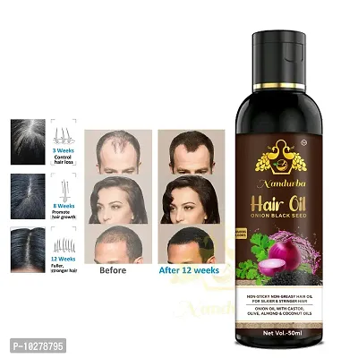 Onion Hair Oil With 14 Essential Oils For Hair Regrowth, Dandruff Control , Black Seed - Hair Care , For Hair Growth Blend Of Multiple Essential Oils Hair Oil For Man And Women 50Ml-thumb0