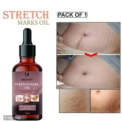 Stretch Marks Oil Stretch Mark Oil For Women And Men - Scars, Uneven Skin Tone And Spots Removal Oil 40 Ml