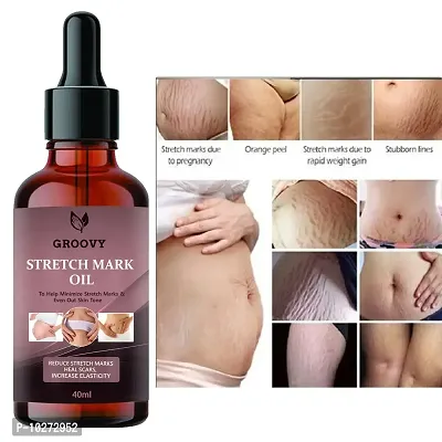 Stretch Marks Oil present Repair Stretch Marks Removal - Natural Heal Pregnancy Breast, Hip, Legs, Mark Oil 40 Ml-thumb0