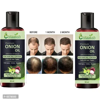 Ayurvedic Onion with black seed Oil for Controls Hair Fall Hair Oil 50ml  pack of 1  PACK OF 2-thumb0