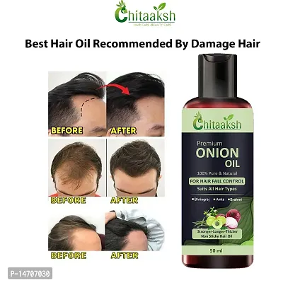 Onion Oil for Hair Regrowth Hair Oil  pack of 1 combo 50 ml hair oil ,For Man And Woman.