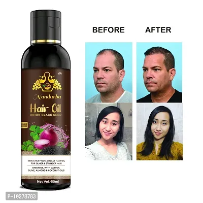 Red Onion Oil Help For Rapid Hair Growth,Anti Hair Fall,Split Hair And Promotes Softer And Shinier Hair 50Ml, For Man And Women-thumb0