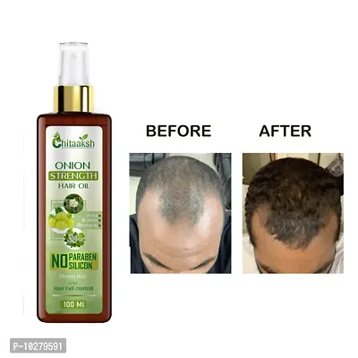 Onion Oil For Hair Regrowth And Hair Fall Control Hair Oil - 100 Ml-thumb0