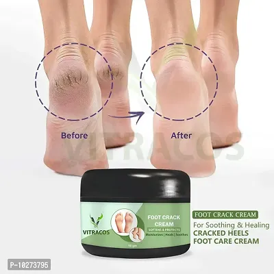 Foot Crack Cream For Dry Cracked Heels And Softening Cream 50Gm