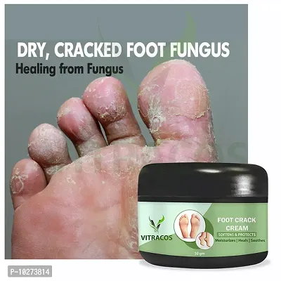 Foot Care Cream For Rough, Feet Cream For Heel Repair Healing And Softening Cream 50 Gm.