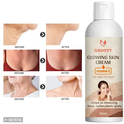 &nbsp;Skin Brightening Cream For Face Body Whitening Cream Dark Spot Remover - 50 ml-thumb0