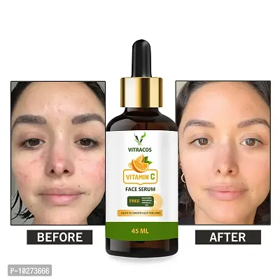 Vitracos Salicylic Acid 2% Anti Pimple Face Serum , Help Lighten Acne Scars ,Oil Control And Acne Breakouts - 45Ml