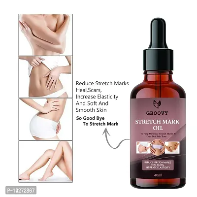 Present Repair Stretch Marks Removal - Natural Heal Pregnancy Breast, Hip, Legs, Mark Oil 40 Ml-thumb0