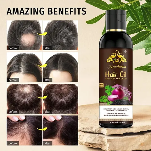 Onion Hair Oil For Hair Growth And Anti Dandruff Oil