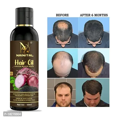 Onion With Black Seed Oil For Controls For Man And Women Hair Fall Hair Oil 50Ml-thumb0