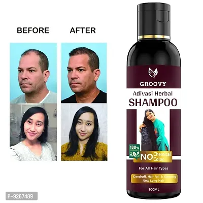 Adivasi neelambari Premium quality hair medicine shampoo for Dandruff C
