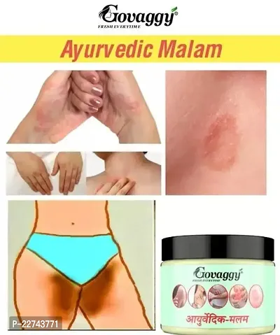 NEW Ayurvedic ItchCoat Anti fungal Malam for Ringworm, itching, Eczema and Fungal Infection