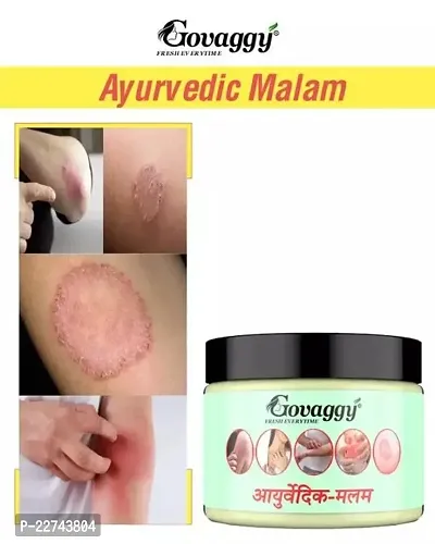 100 % Ayurvedic ItchCoat Anti fungal Malam for Ringworm, itching, Eczema and Fungal Infection-thumb0