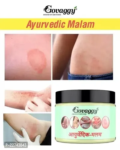 Ayurvedic ItchCoat Anti fungal Malam for Ringworm, itching, Eczema and Fungal Infection