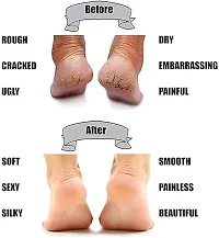 Anti Crack Full Length Silicone Foot Protector Moisturizing Socks for Foot-Care and Heel Cracks,socks for cracked feet,heel pad for heel pain,anti crack heel socks-thumb1